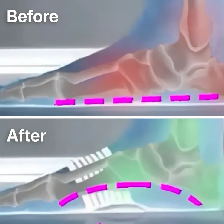 1 1 FREE | Soleil™ Orthopedic Arch Support