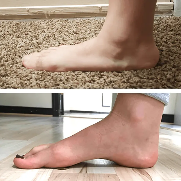 1 1 FREE | Soleil™ Orthopedic Arch Support
