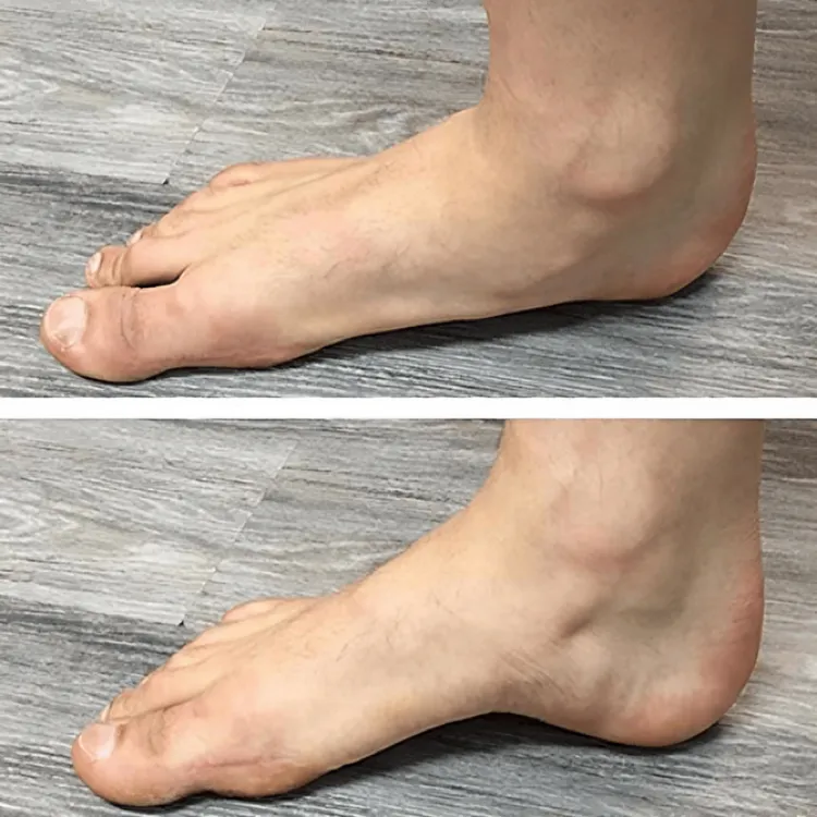 1 1 FREE | Soleil™ Orthopedic Arch Support